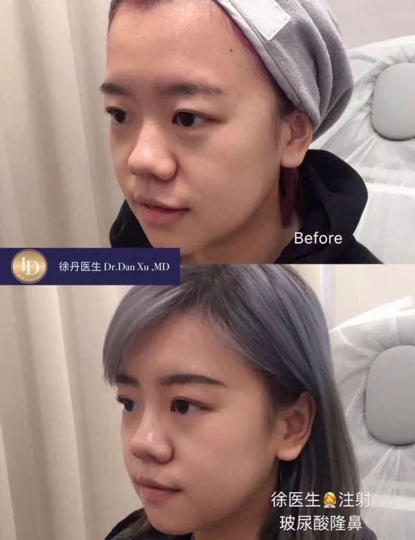 名人博主御用医美：美的万里挑一，绝不千篇一律