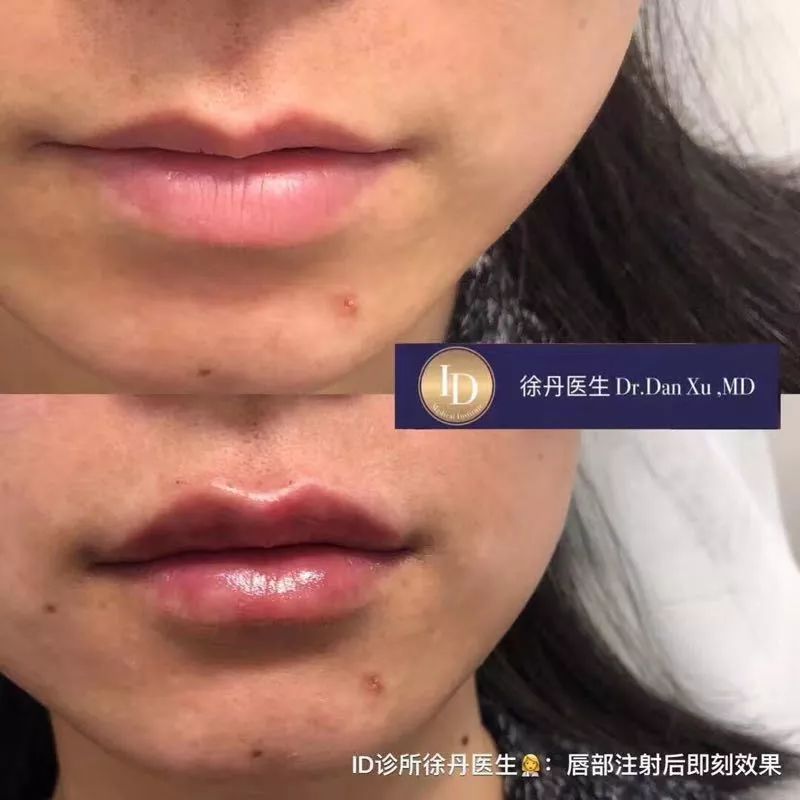 名人博主御用医美：美的万里挑一，绝不千篇一律