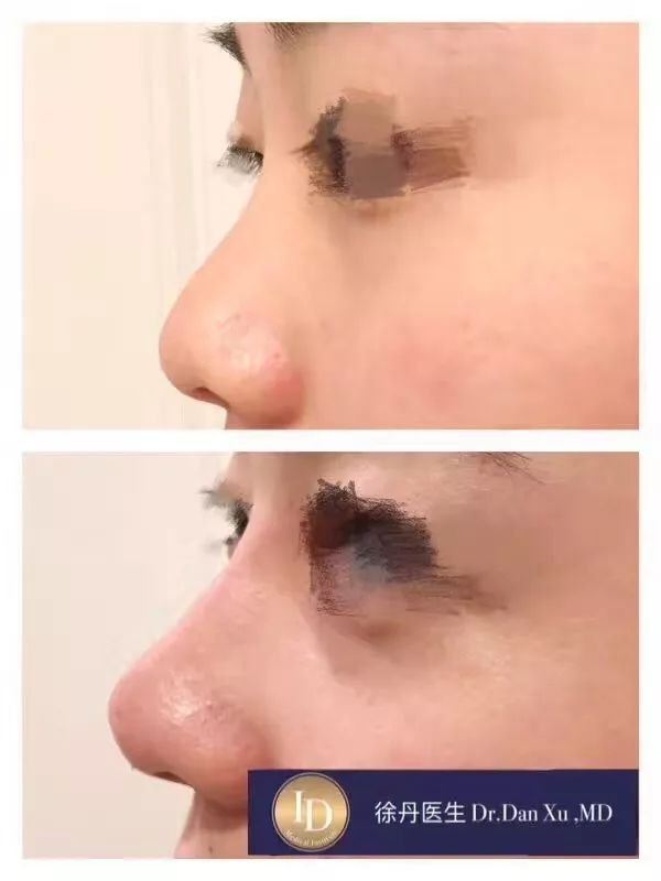 名人博主御用医美：美的万里挑一，绝不千篇一律