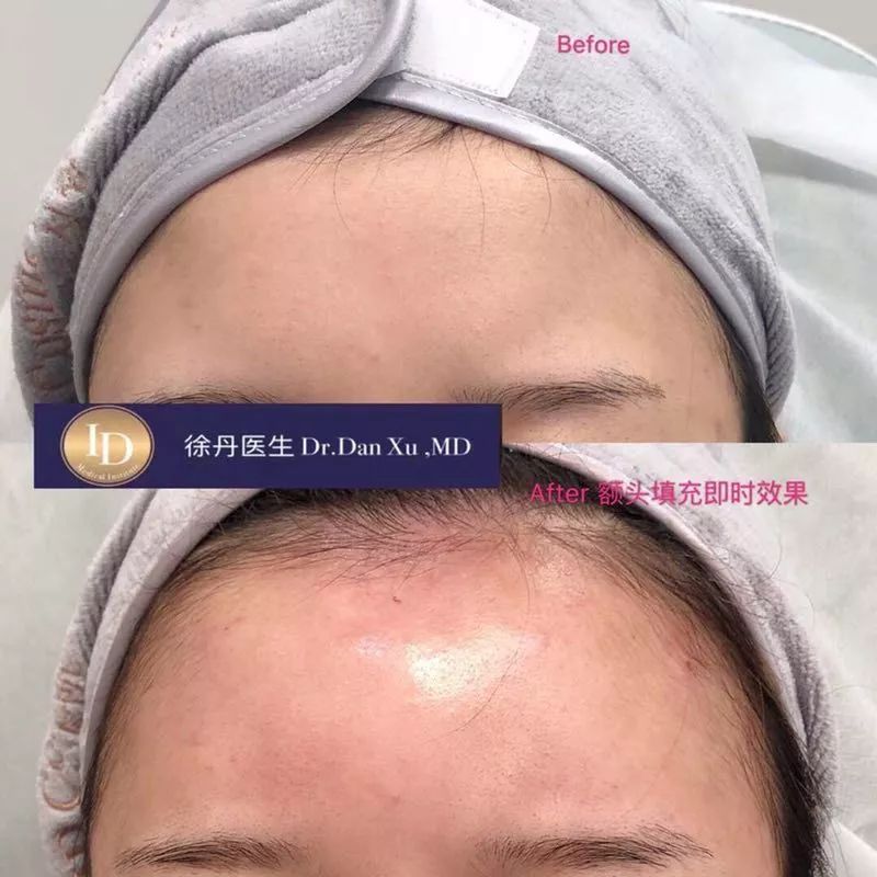名人博主御用医美：美的万里挑一，绝不千篇一律