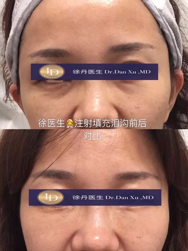 名人博主御用医美：美的万里挑一，绝不千篇一律