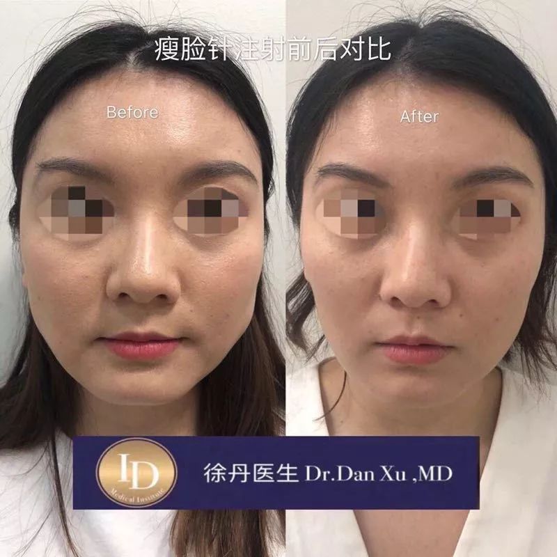 名人博主御用医美：美的万里挑一，绝不千篇一律