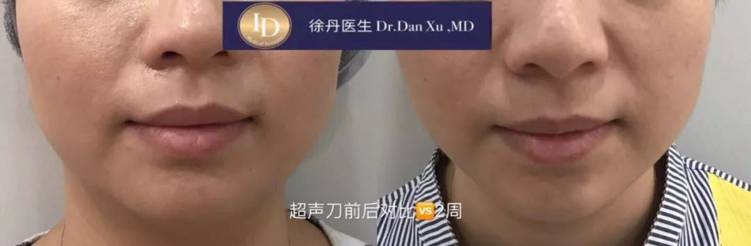 名人博主御用医美：美的万里挑一，绝不千篇一律