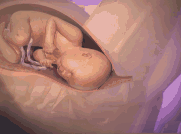 《Nature》杂志新发现：剖腹产的婴儿缺少菌群，容易生病...