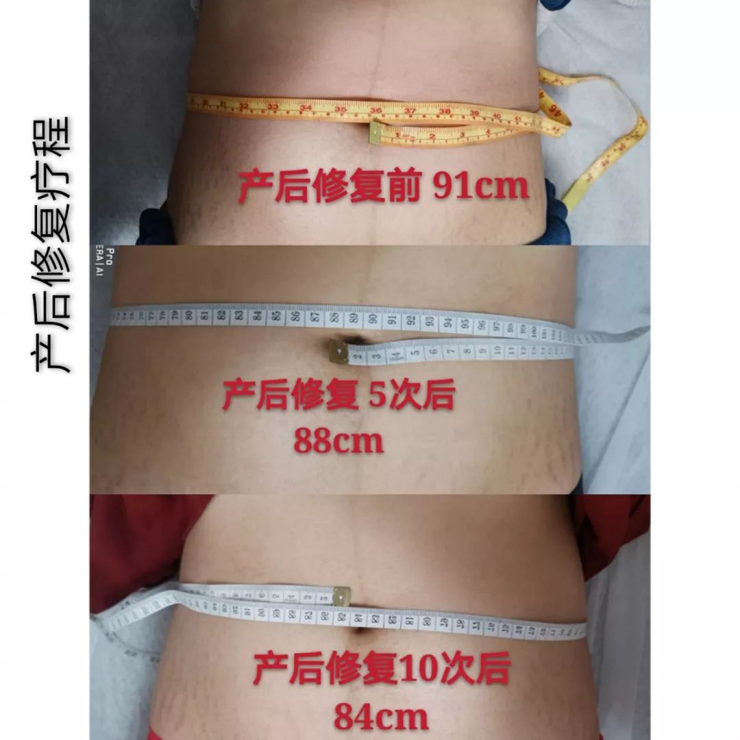 产后能做到这4点，明星同款身材你也能get！