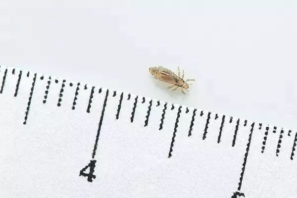 你家娃最近头痒痒吗？学校又开始闹虱子了！