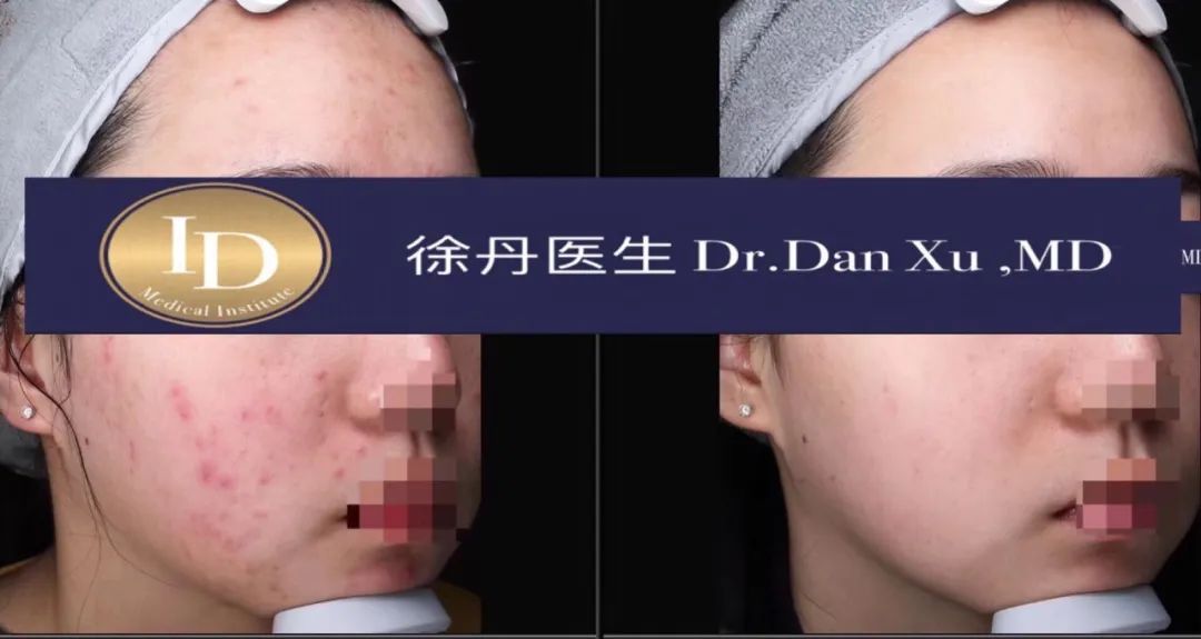 前后变化有多大?自己看吧,口碑推荐,我夸累了! 前后变化有多大?自己看吧,口碑推荐,我夸累了!