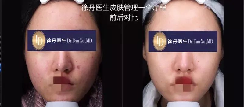 前后变化有多大?自己看吧,口碑推荐,我夸累了! 前后变化有多大?自己看吧,口碑推荐,我夸累了!