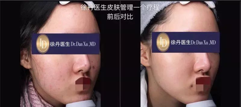 前后变化有多大?自己看吧,口碑推荐,我夸累了! 前后变化有多大?自己看吧,口碑推荐,我夸累了!