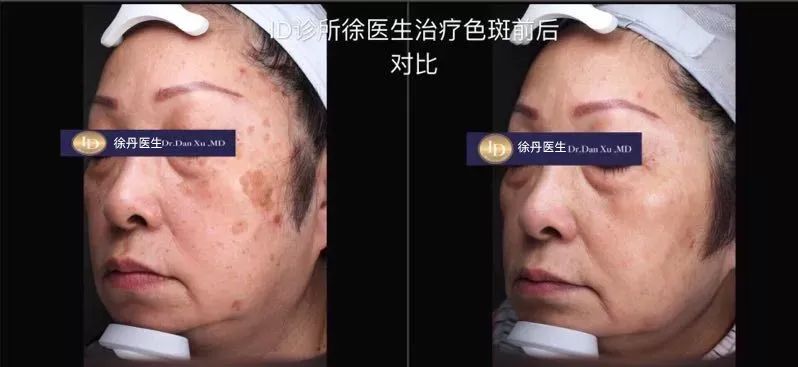 前后变化有多大?自己看吧,口碑推荐,我夸累了! 前后变化有多大?自己看吧,口碑推荐,我夸累了!
