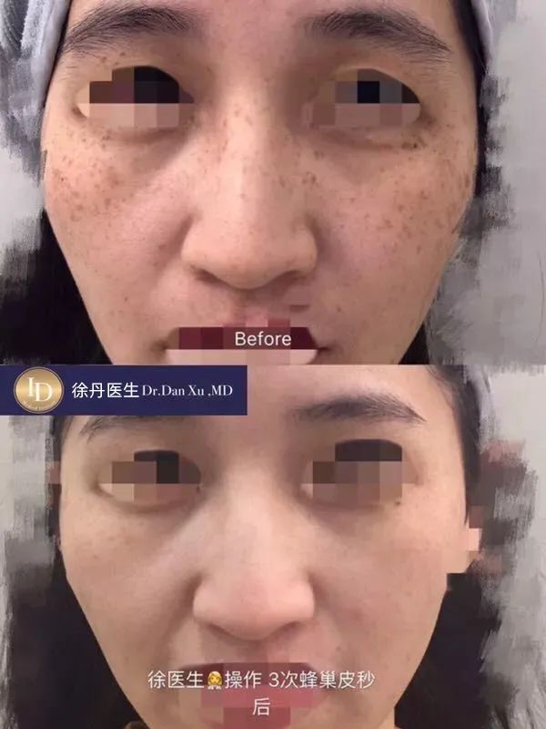前后变化有多大?自己看吧,口碑推荐,我夸累了! 前后变化有多大?自己看吧,口碑推荐,我夸累了!