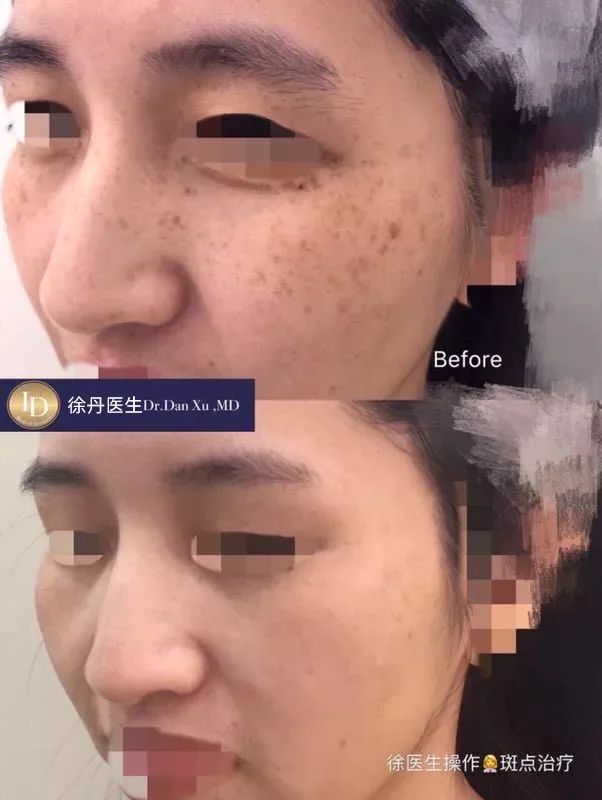 前后变化有多大?自己看吧,口碑推荐,我夸累了! 前后变化有多大?自己看吧,口碑推荐,我夸累了!