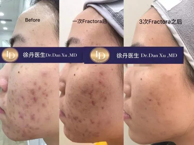 前后变化有多大?自己看吧,口碑推荐,我夸累了! 前后变化有多大?自己看吧,口碑推荐,我夸累了!