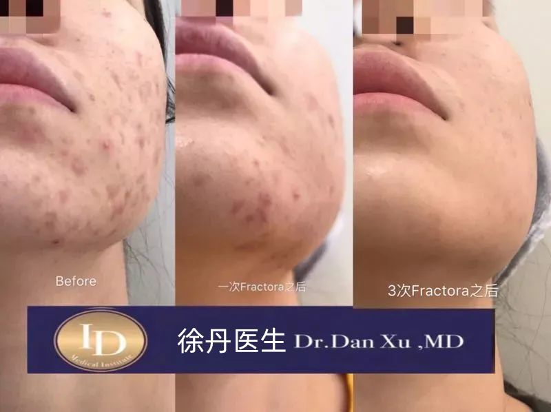前后变化有多大?自己看吧,口碑推荐,我夸累了! 前后变化有多大?自己看吧,口碑推荐,我夸累了!