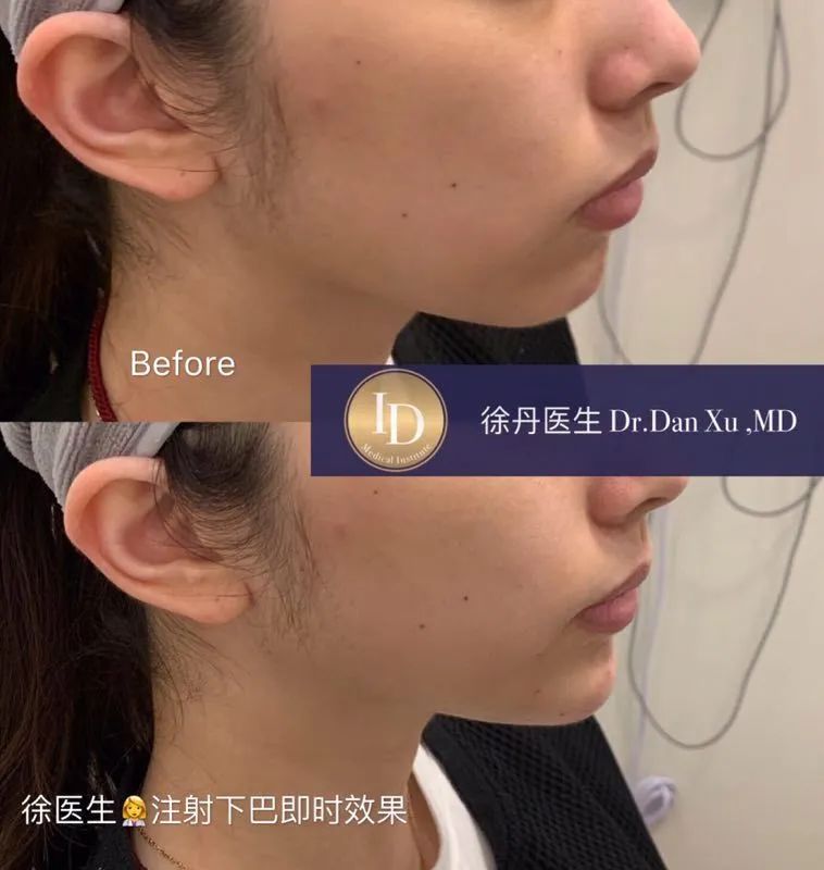 前后变化有多大?自己看吧,口碑推荐,我夸累了! 前后变化有多大?自己看吧,口碑推荐,我夸累了!
