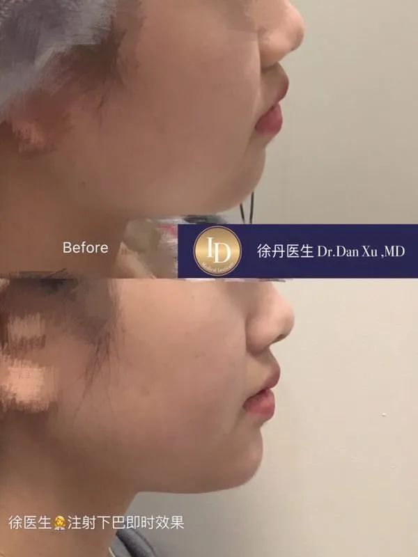前后变化有多大?自己看吧,口碑推荐,我夸累了! 前后变化有多大?自己看吧,口碑推荐,我夸累了!