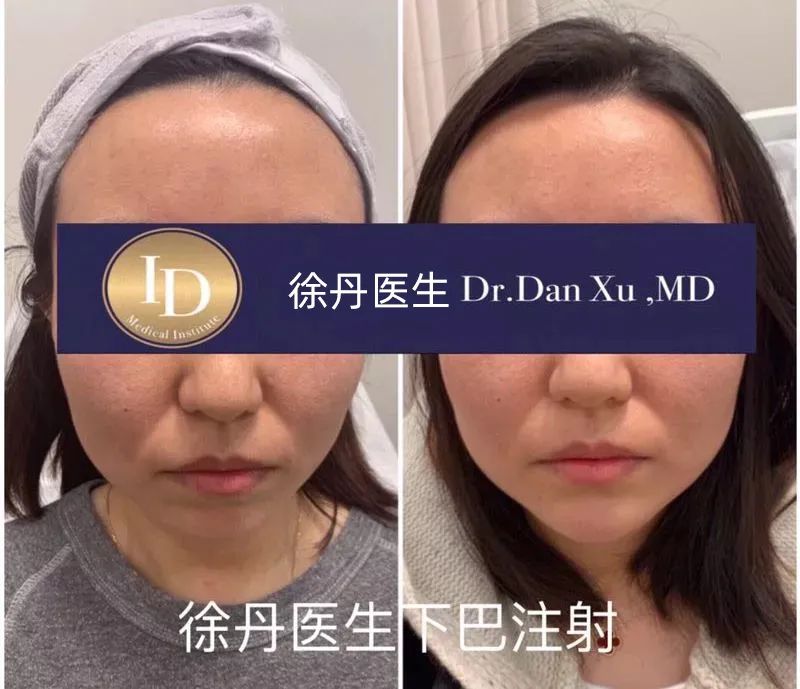 前后变化有多大?自己看吧,口碑推荐,我夸累了! 前后变化有多大?自己看吧,口碑推荐,我夸累了!