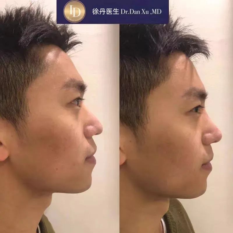 前后变化有多大?自己看吧,口碑推荐,我夸累了! 前后变化有多大?自己看吧,口碑推荐,我夸累了!