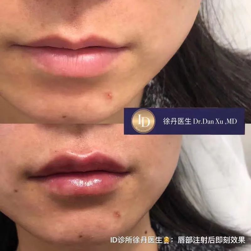 前后变化有多大?自己看吧,口碑推荐,我夸累了! 前后变化有多大?自己看吧,口碑推荐,我夸累了!