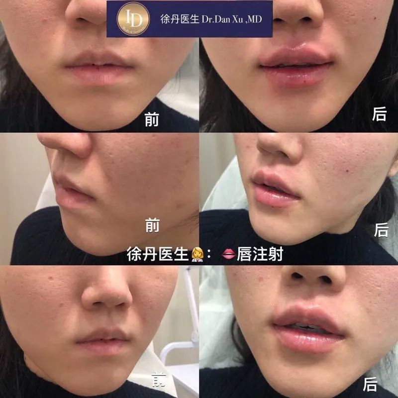 前后变化有多大?自己看吧,口碑推荐,我夸累了! 前后变化有多大?自己看吧,口碑推荐,我夸累了!