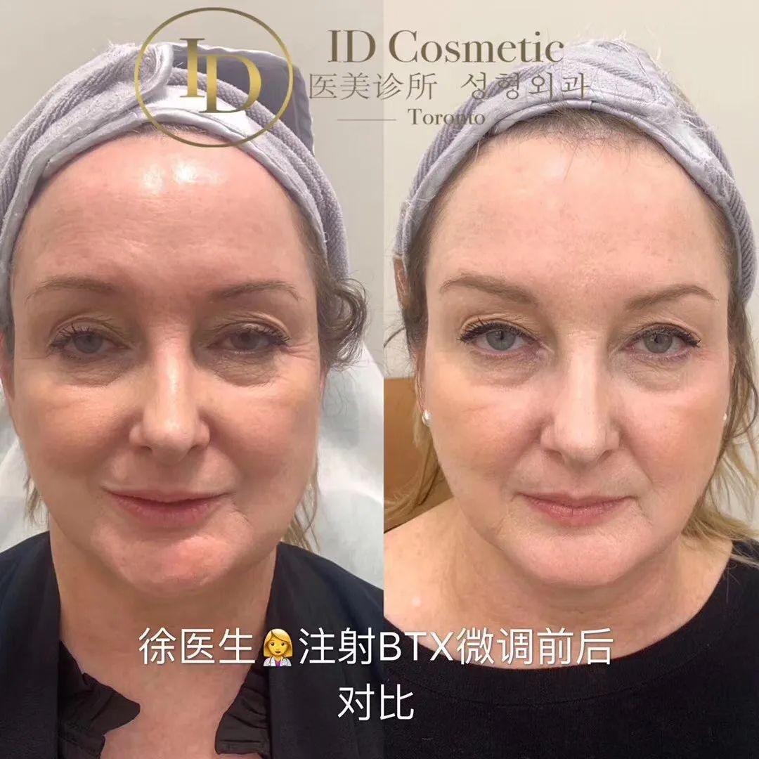 前后变化有多大？自己看吧，口碑推荐，我夸累了！