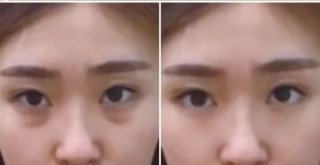 前后变化有多大?自己看吧,口碑推荐,我夸累了! 前后变化有多大?自己看吧,口碑推荐,我夸累了!