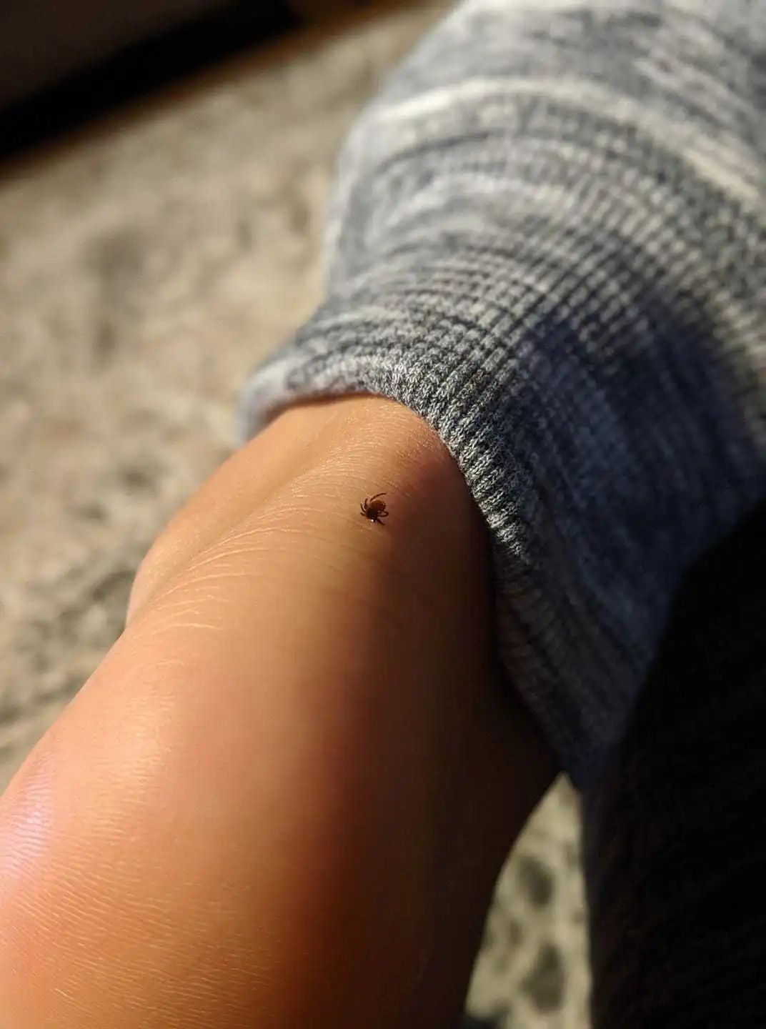 孩子被咬一口就全身麻痹瘫痪，这种吸血小虫又回归土狼屯！