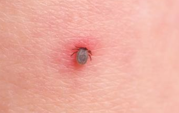 孩子被咬一口就全身麻痹瘫痪，这种吸血小虫又回归土狼屯！