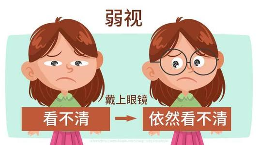 大眼睛咘咘患上弱视? 健康卡全包的眼科检查了解一下 大眼睛咘咘患上弱视? 健康卡全包的眼科检查了解一下