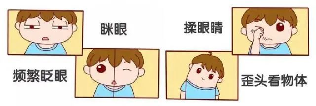 大眼睛咘咘患上弱视? 健康卡全包的眼科检查了解一下 大眼睛咘咘患上弱视? 健康卡全包的眼科检查了解一下