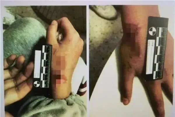 丧心病狂!暴力鸡娃:亲妈烧热锅铲烫孩子,就为多背几个单词... 丧心病狂!暴力鸡娃:亲妈烧热锅铲烫孩子,就为多背几个单词...