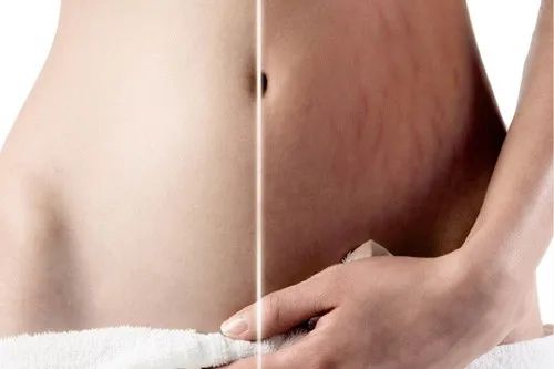 快来变女神！多伦多华人妈妈有福利，五大豪礼拿不停！