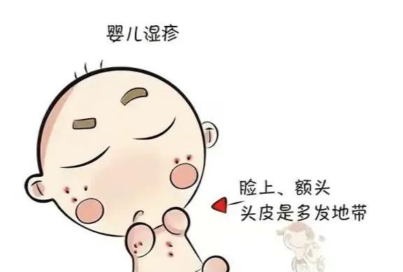 越痒越搔越痒，幼儿湿疹如何护理？到底哪款湿疹霜好用？