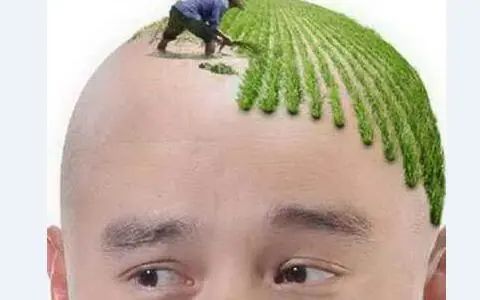 为了不秃踩过的雷：头上还有一根毛，这场battle就不算输