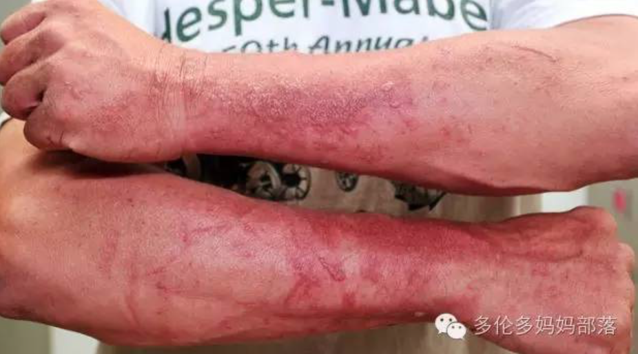 有毒！越不起眼越有毒！加拿大这些常见的花花草草千万别让孩子碰！