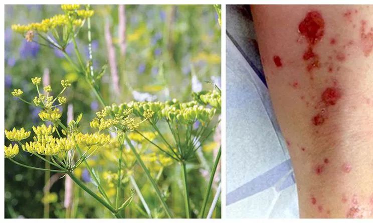 有毒！越不起眼越有毒！加拿大这些常见的花花草草千万别让孩子碰！