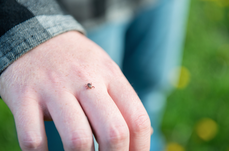 安省蜱虫爆发季：有孩子被咬差点瘫痪，咬后必须这么处理