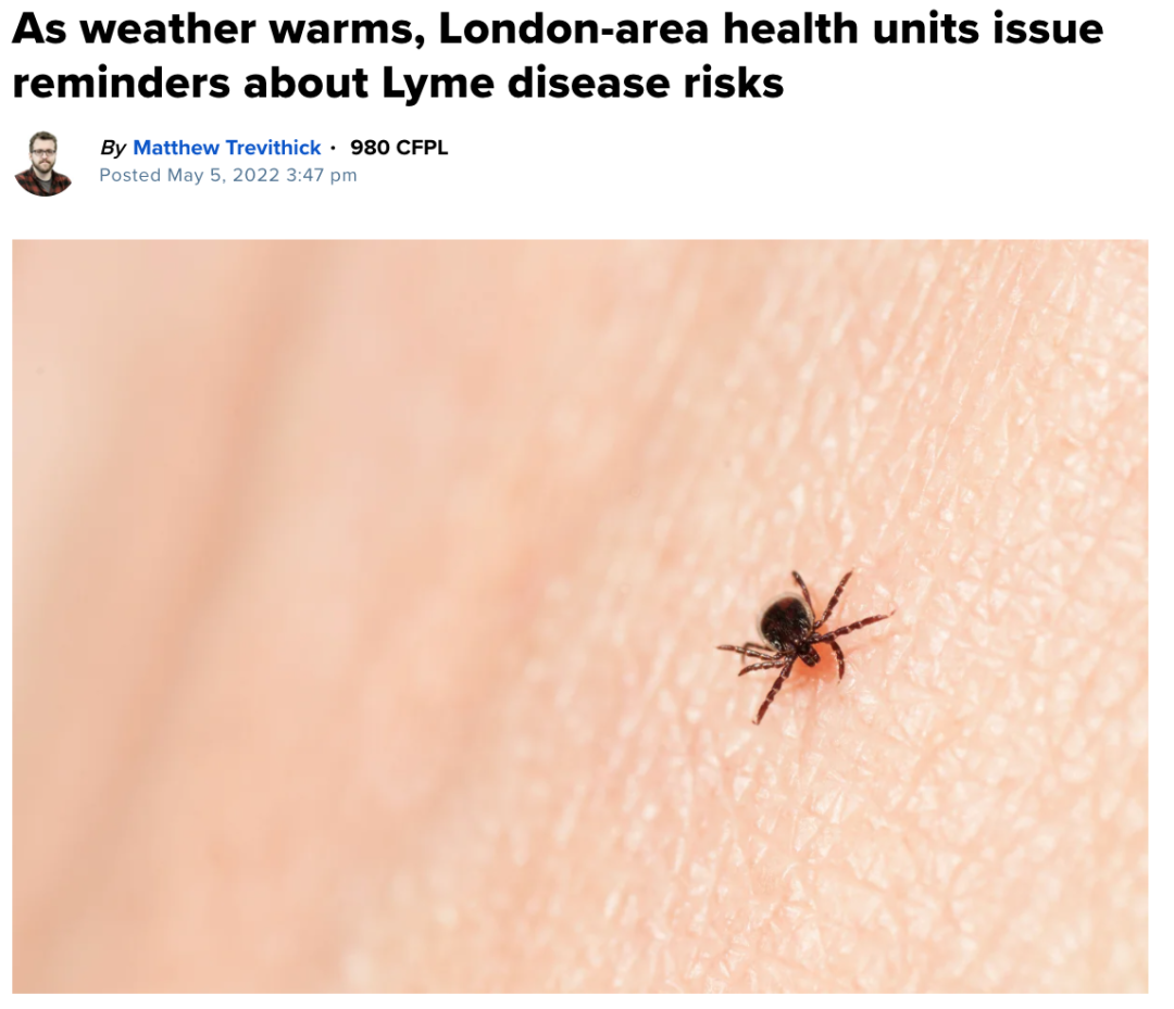 安省蜱虫爆发季：有孩子被咬差点瘫痪，咬后必须这么处理