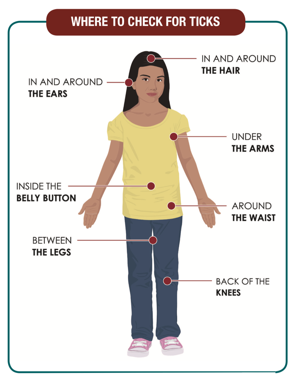 安省蜱虫爆发季：有孩子被咬差点瘫痪，咬后必须这么处理