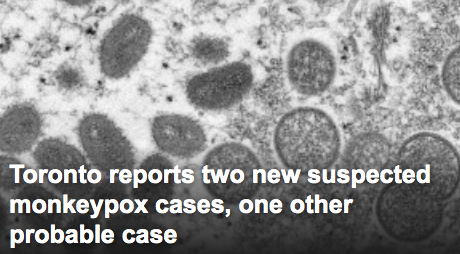 糟心！多伦多发现4起猴痘病例，全省积压手术已超100万台