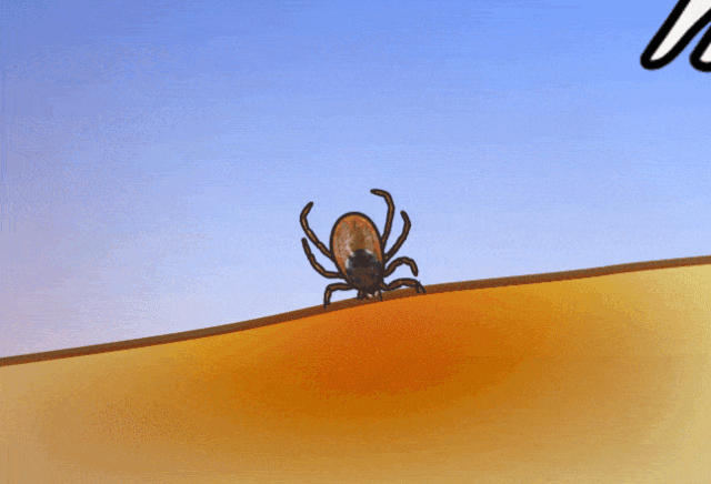 安省蜱虫爆发季：有孩子被咬差点瘫痪，咬后必须这么处理