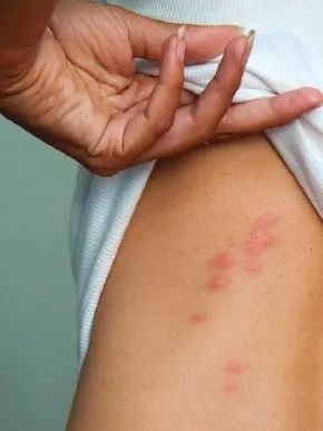 【多虫图慎点】灭虫公司：今年会有7种害虫叠buff暴击，教你如何反抗