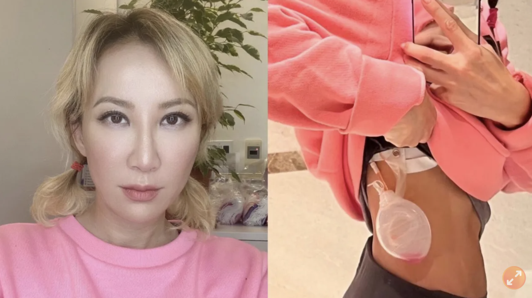 CoCo李玟因抑郁症自杀去世!她曾说:“每天晚上我都在被折磨...” CoCo李玟因抑郁症自杀去世!她曾说:“每天晚上我都在被折磨...”