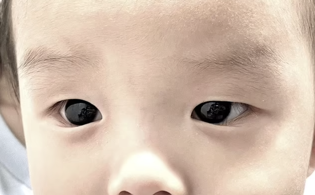 6个月大男孩服用儿童新冠特效药后，眼珠子从棕色变成了蓝色