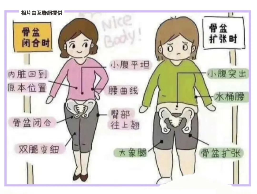 古法扎肚、骨盆修复有没有用？一组Before VS After 前后对比告诉她