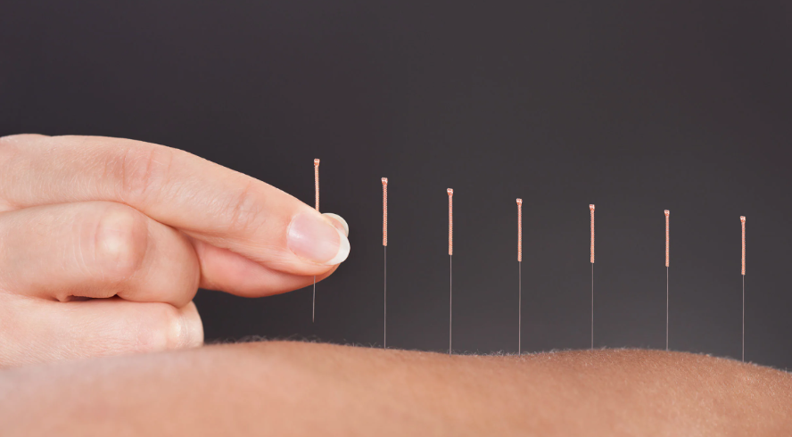 平均时薪$60!含实习的注册针灸师课程:符合要求可免费就读 平均时薪$60!含实习的注册针灸师课程:符合要求可免费就读