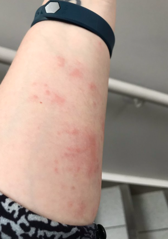 差点原地去世!多伦多今年不撒药了:避免毛毛虫爆发要怎么做? 差点原地去世!多伦多今年不撒药了:避免毛毛虫爆发要怎么做?