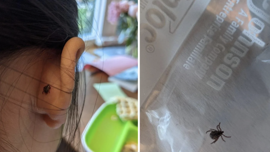 钻进皮肤拔不出来，被咬可能致死！安省蜱虫大爆发：除虫神器找到了